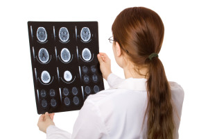 Female doctor examining a brain cat scan.